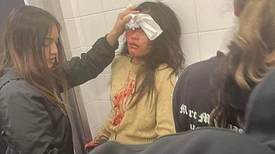 气愤！北岸亚裔女生遇袭，光天化日遭群殴，被打得满脸是血……