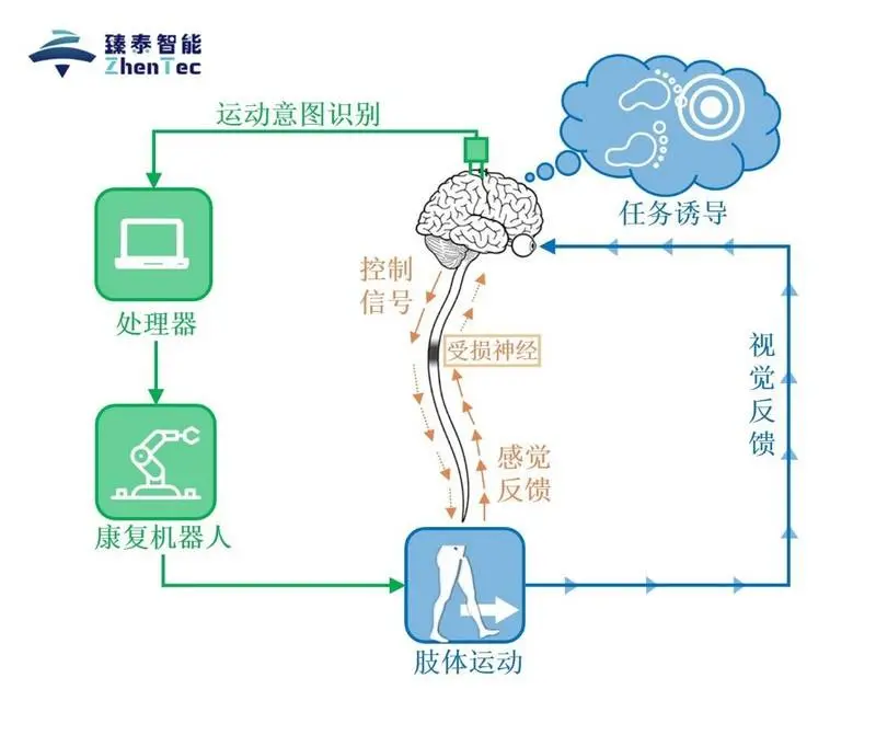 将脑机接口技术应用于医疗康复，「臻泰智能」获联想创投数百万元天使轮融资