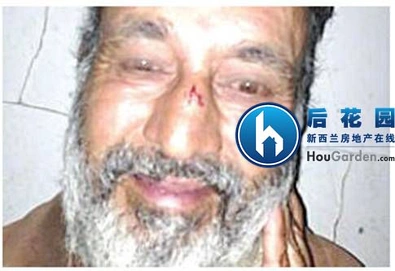 无家可归者遭暴力袭击命丧黄泉
