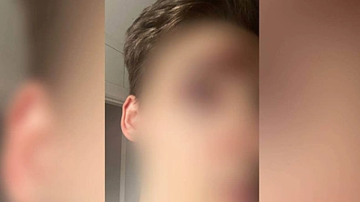 事发奥克兰CBD公园！多人遭到拦路抢劫，无辜民众被打到头破血流，更糟心的还在后头……