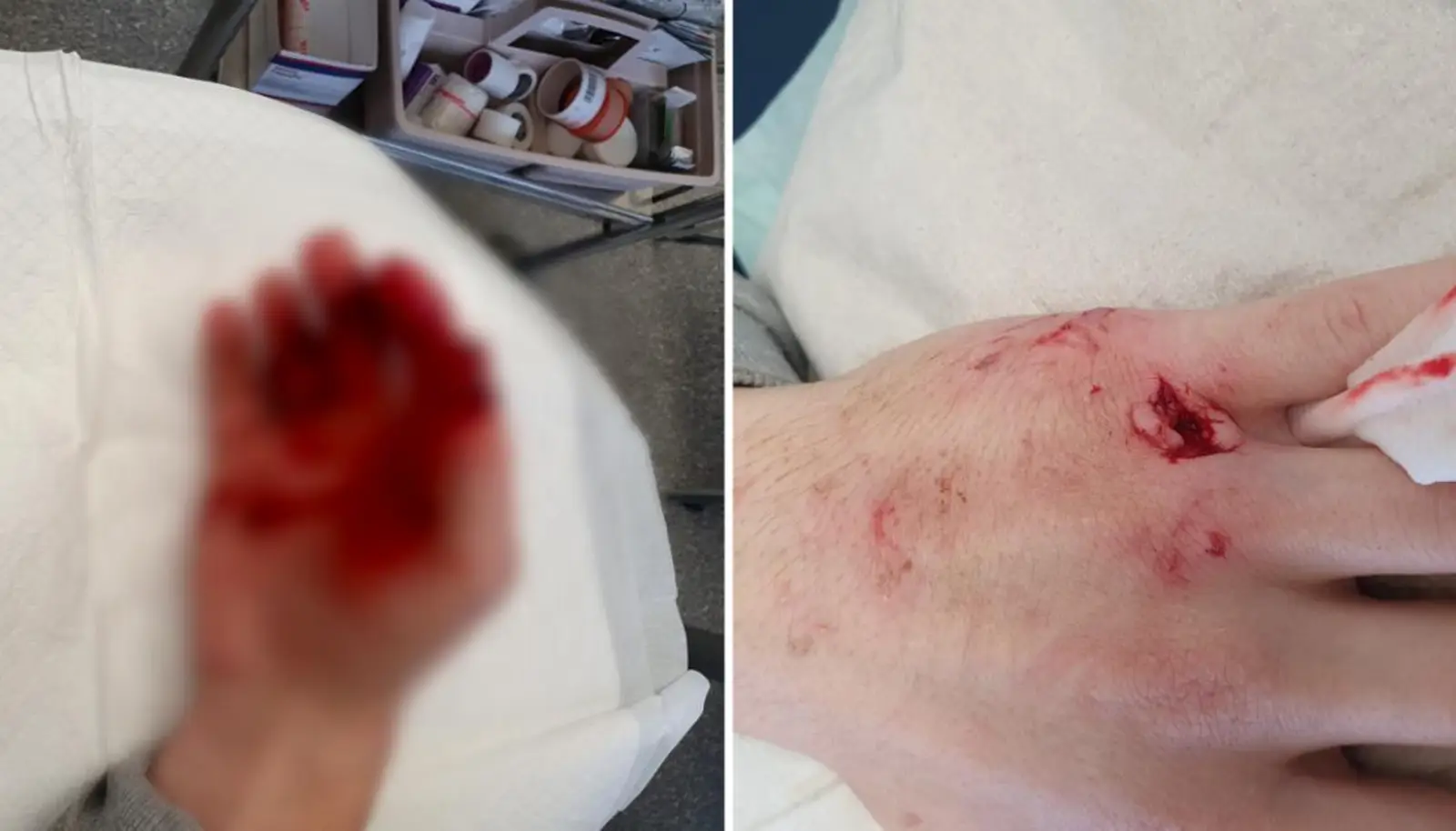 可怕!奥克兰公园恶犬袭人,男子遭疯狂撕咬、浑身是血,更可气的事在后头……