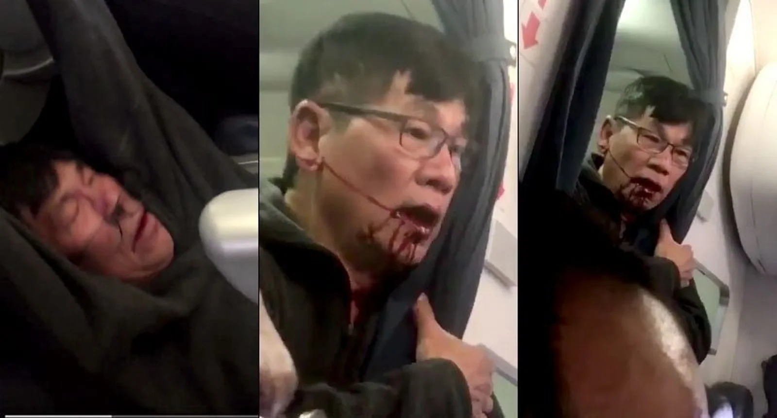 美联航机票超订强制乘客改签,一华人被拽离座位拖下飞机满脸是血