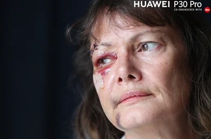 单身熟女在奥克兰酒吧无端被暴打，鼻断眼裂面目全非