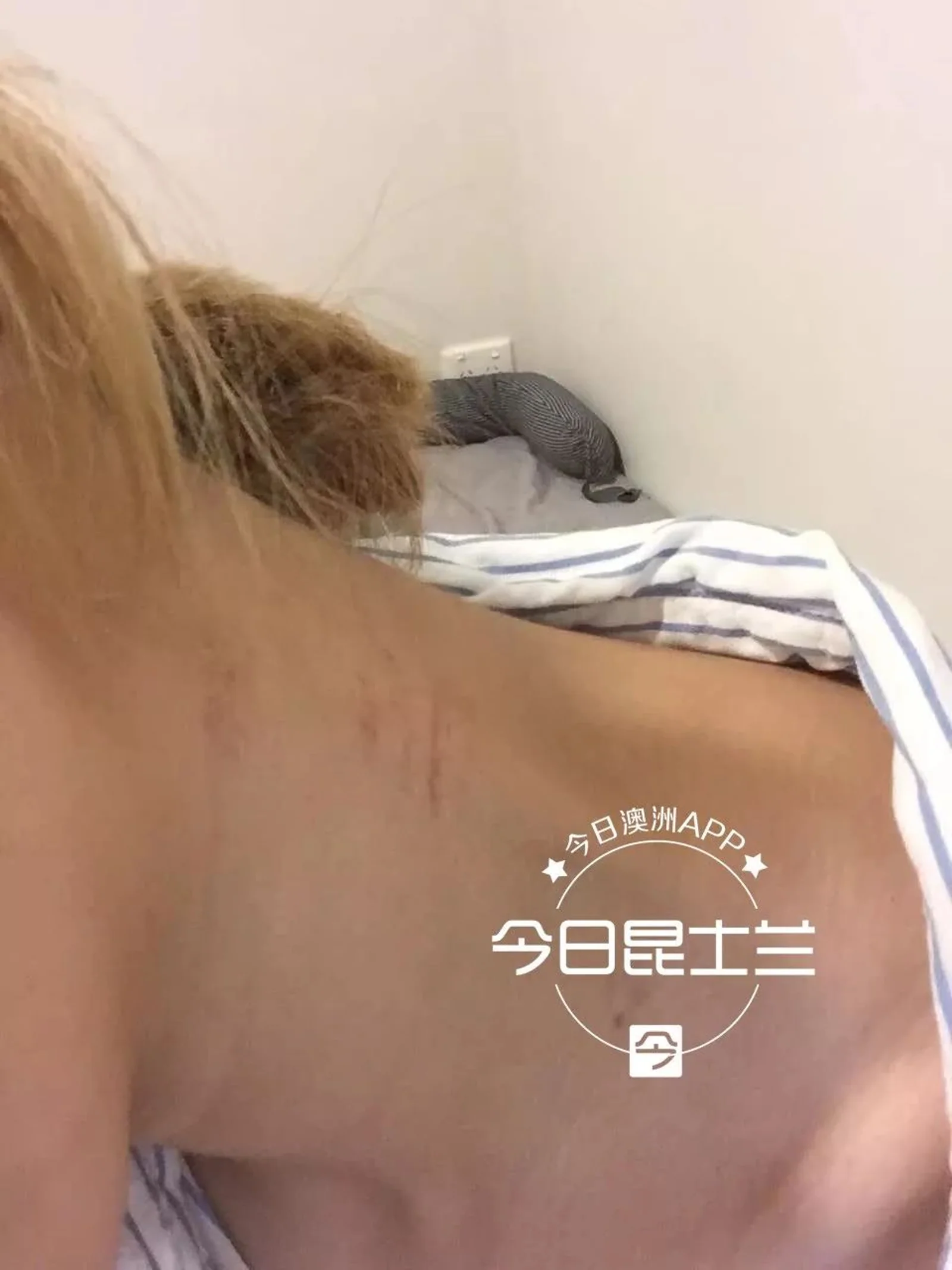 布里斯班中国女留学生自曝遭男友家暴，“得到我的身体就变了！”男友却回应：有苦无人倾诉！“她是在报复我，不希望我好！”