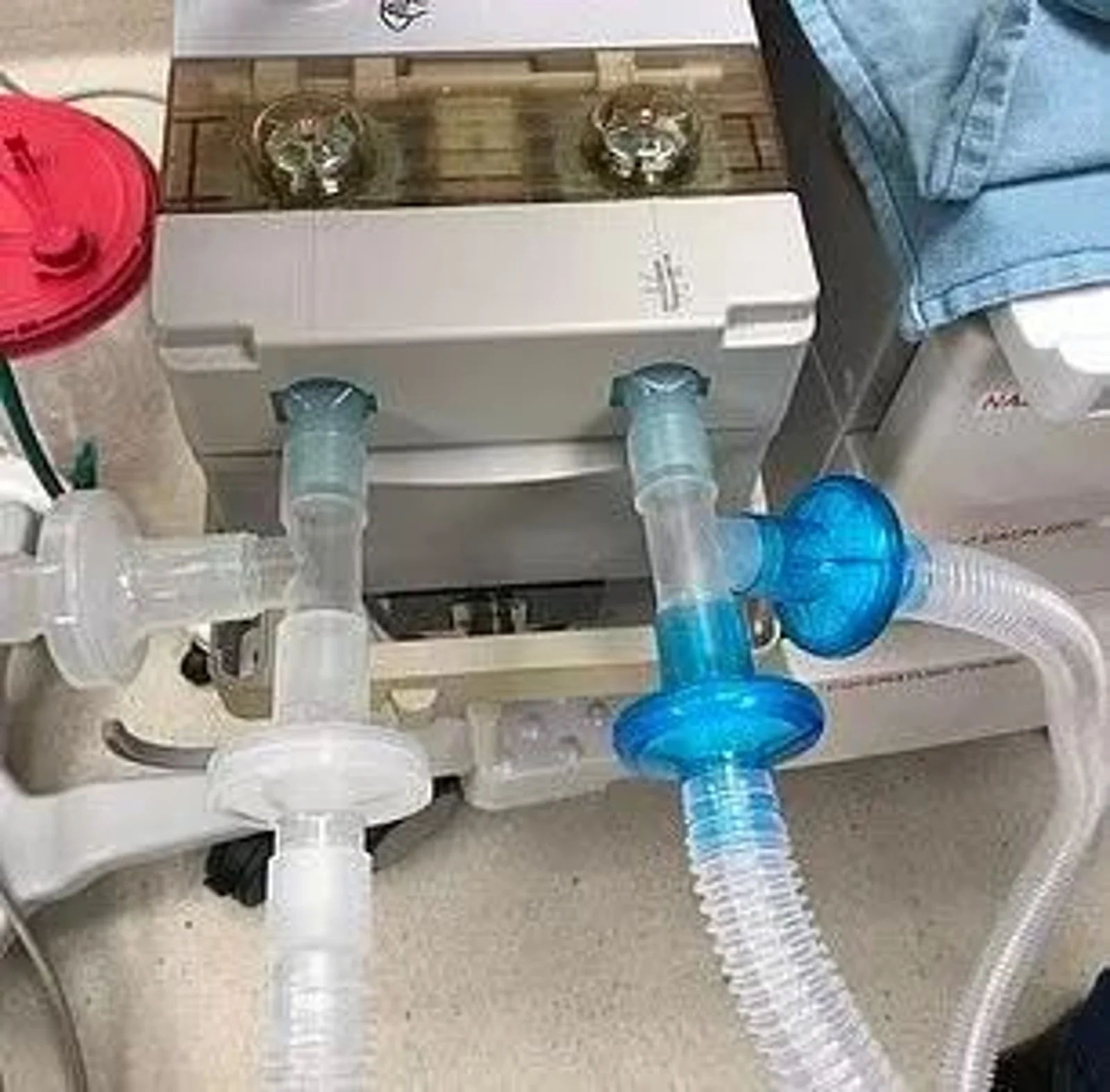 点赞！加拿大天才医生改造呼吸机，一台能供9名患者使用！