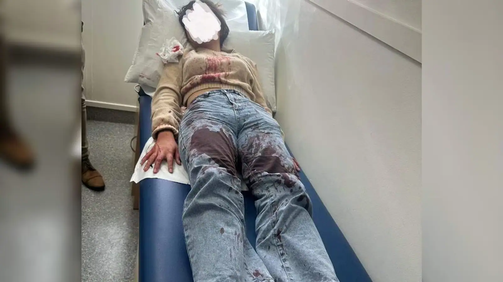 气愤!北岸亚裔女生遇袭,光天化日遭群殴,被打得满脸是血……