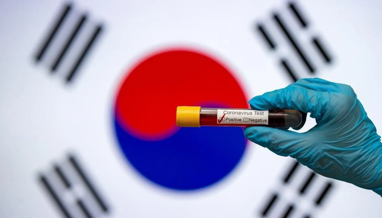 “韩国病例”二次检测仍为阳性！卫生部紧急呼吁，奥克兰、皇后镇居民进行检测！