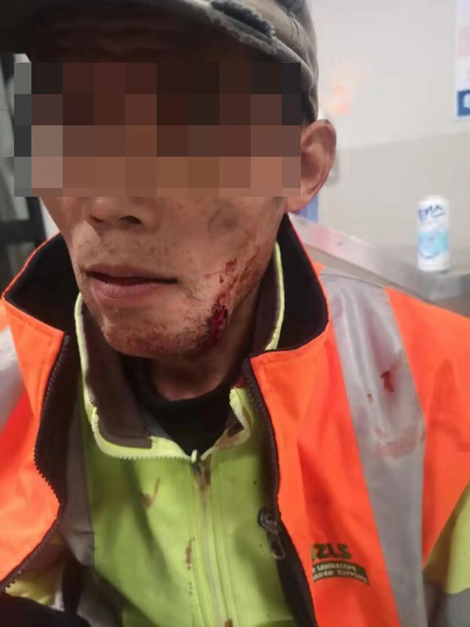 什么仇什么怨？中国建筑工人在奥克兰被暴打，案发8小时警方才处理