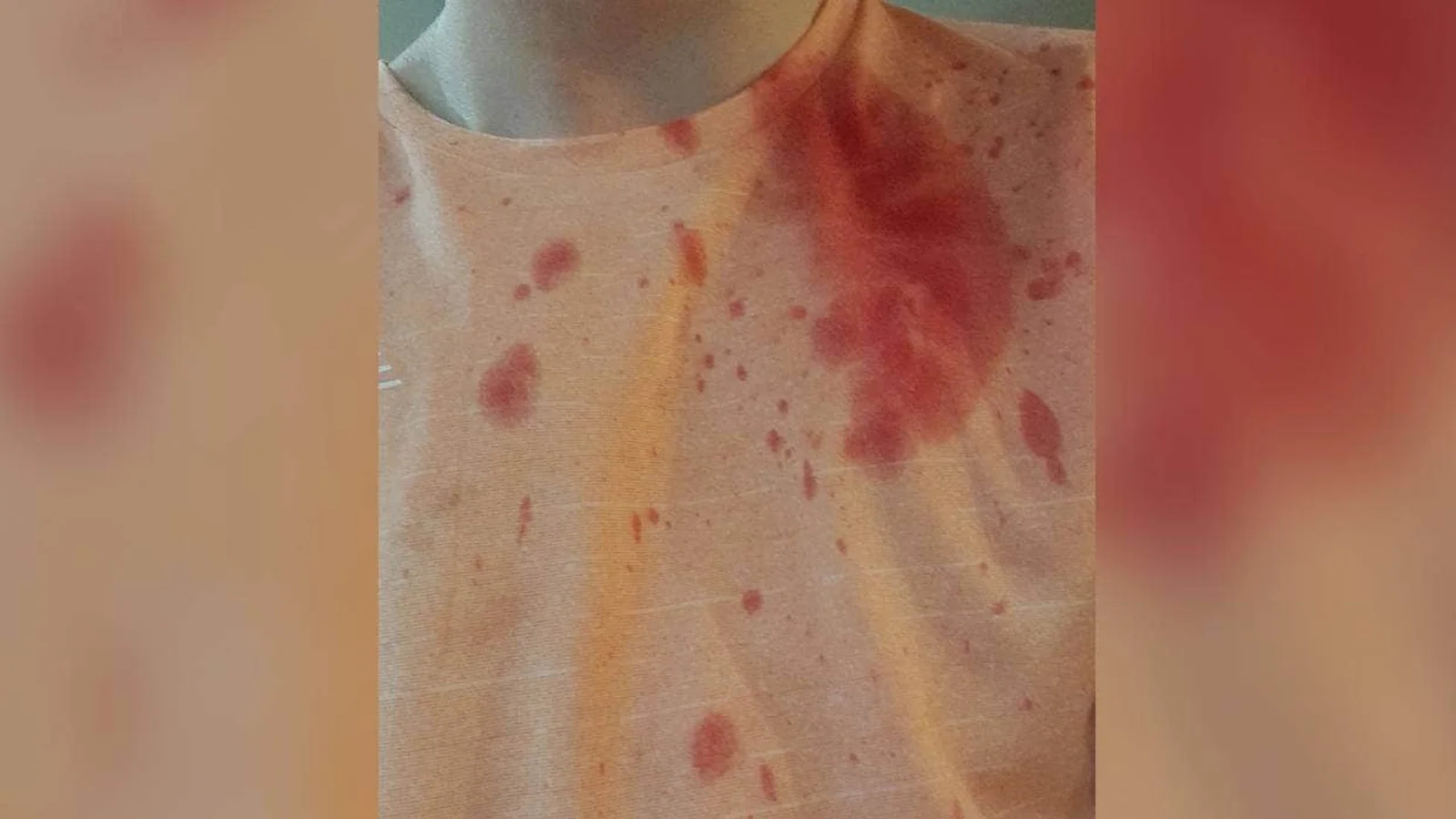 事发奥克兰CBD公园！多人遭到拦路抢劫，无辜民众被打到头破血流，更糟心的还在后头……