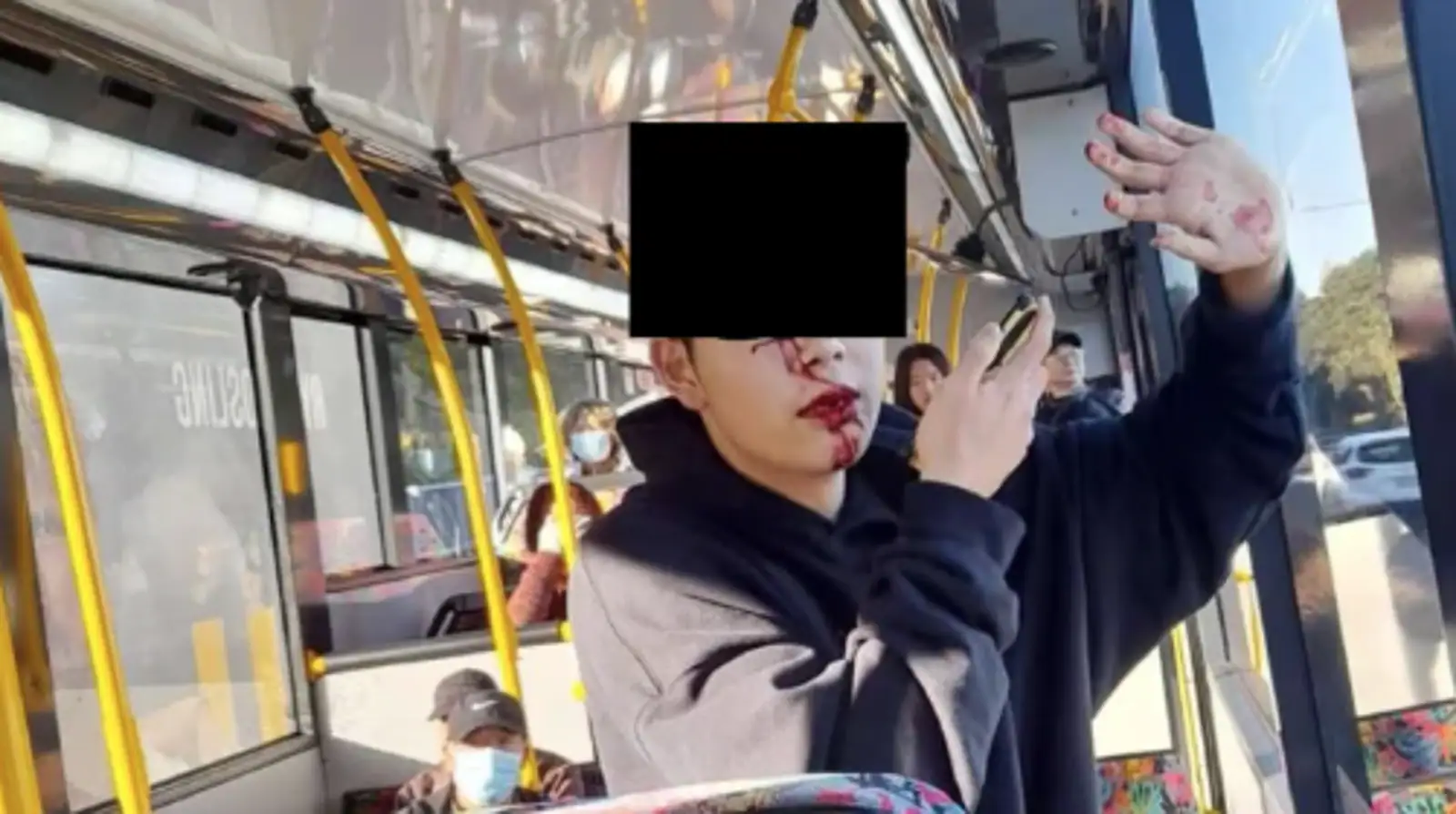 奥克兰华人学生遭种族歧视,公交车上被无辜殴打致牙齿脱落