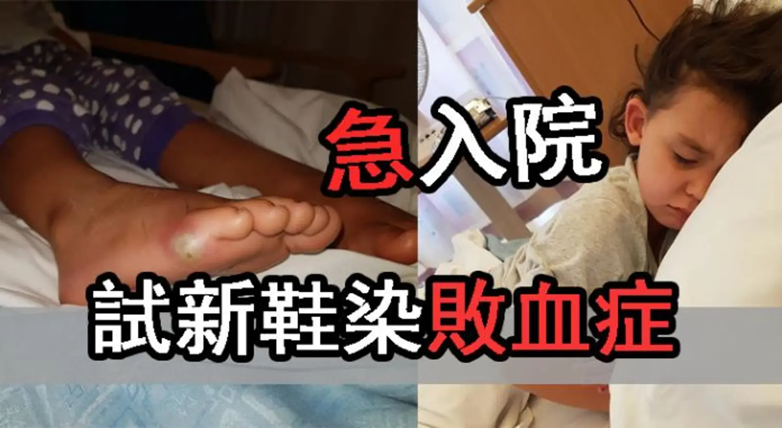 可怕！妈妈带小女儿去买鞋，第二天她双腿流脓竟有生命危险要截肢！