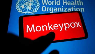 吓人！新西兰新增9例猴痘社区传染病例，其中7例都在奥克兰！
