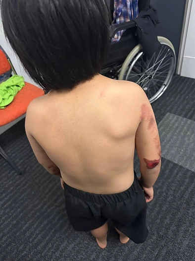 气愤！奥克兰祖孙二人坐公交险丧命，司机一个操作致其重伤，很多人都遇到过！