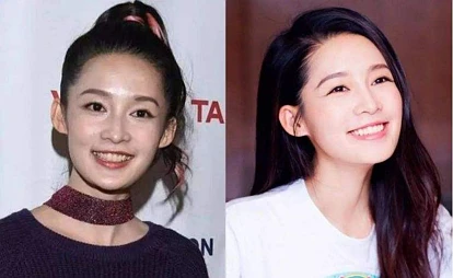 为什么明星的牙齿都那么干净整齐好看?